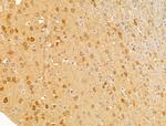 XAF1 Antibody in Immunohistochemistry (Paraffin) (IHC (P))