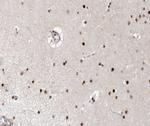 XPA Antibody in Immunohistochemistry (Paraffin) (IHC (P))