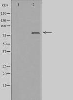 ZC3H11A Polyclonal Antibody