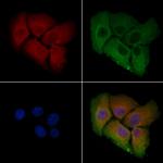 ZDHHC7 Polyclonal Antibody