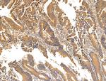 ZNF281 Polyclonal Antibody