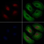 ZNF143 Polyclonal Antibody