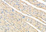 ZP2 Polyclonal Antibody