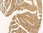 PHOSPHO1 Polyclonal Antibody