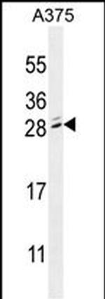 MBD3L2 Polyclonal Antibody