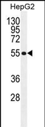 TETRAN Polyclonal Antibody