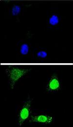WDR70 Polyclonal Antibody