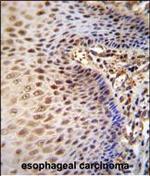 WDR70 Antibody in Immunohistochemistry (Paraffin) (IHC (P))