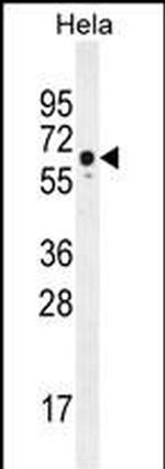 WDR70 Antibody in Western Blot (WB)