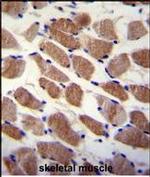 SAMD7 Polyclonal Antibody