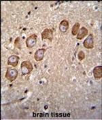 VSTM2B Polyclonal Antibody