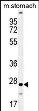 VSTM2B Antibody in Western Blot (WB)