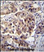 hCG 1995004 Polyclonal Antibody
