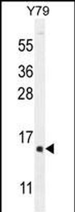 hCG 1995004 Antibody in Western Blot (WB)
