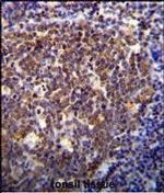 HOXB6 Polyclonal Antibody