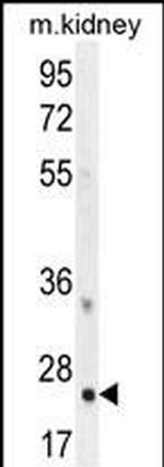 HOXB6 Antibody in Western Blot (WB)