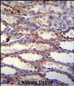 SHISA3 Polyclonal Antibody