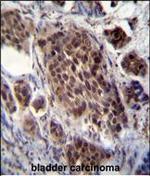FRAT2 Antibody in Immunohistochemistry (Paraffin) (IHC (P))