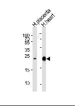 FRAT2 Antibody in Western Blot (WB)