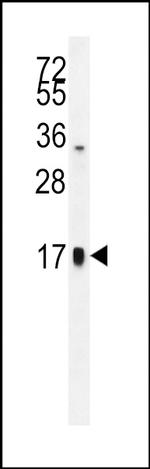 CGA Antibody in Western Blot (WB)