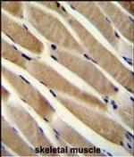 RNF90 Polyclonal Antibody