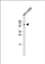 RNF90 Antibody in Western Blot (WB)