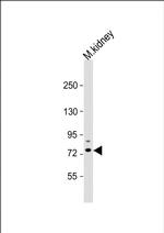 TIPARP Polyclonal Antibody