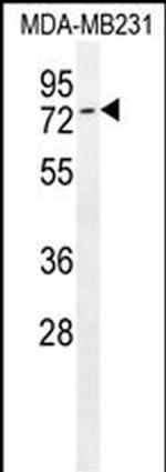 TIPARP Antibody in Western Blot (WB)