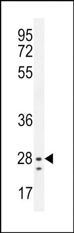 NIPSNAP3B Antibody in Western Blot (WB)