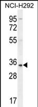 SFTPA2 Polyclonal Antibody
