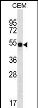 DAZ3 Antibody in Western Blot (WB)