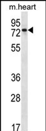 PARP2 Polyclonal Antibody