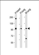 SPON1 Polyclonal Antibody
