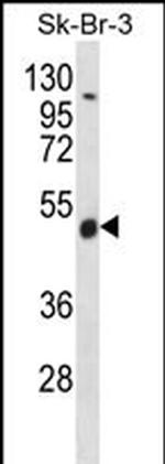 WDR34 Polyclonal Antibody