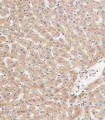 LC3B Polyclonal Antibody