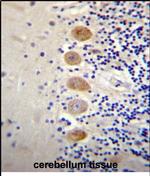 GPR111 Polyclonal Antibody