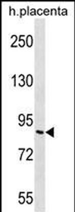 GPR111 Antibody in Western Blot (WB)