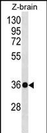 HOXD10 Polyclonal Antibody