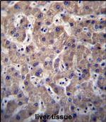 SULT1A3/SULT1A4 Polyclonal Antibody