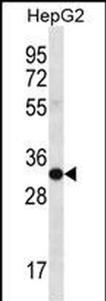 SULT1A3/SULT1A4 Antibody in Western Blot (WB)