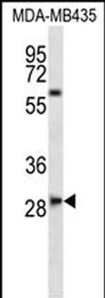 SLAMF8 Polyclonal Antibody