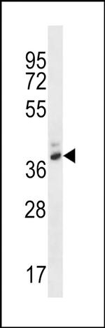 PGA4 Antibody in Western Blot (WB)