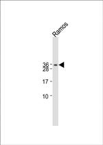 hCG beta Antibody in Western Blot (WB)