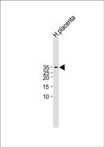 hCG beta Antibody in Western Blot (WB)