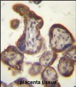 hCG beta Polyclonal Antibody