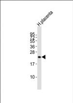 hCG beta Antibody in Western Blot (WB)