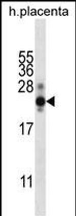 hCG beta Antibody in Western Blot (WB)