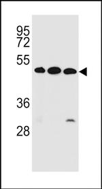 KREMEN2 Polyclonal Antibody
