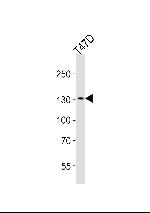 ATAD2 Polyclonal Antibody