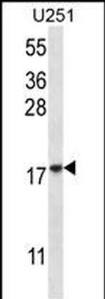 eIF1AY Antibody in Western Blot (WB)